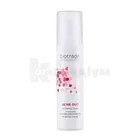 ACNE OUT ПРОТИ ВУГРЕВОГО ВИСИПУ МАТУЮЧИЙ ТОНІК