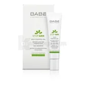 ГЕЛЬ ПРОТИ ПРИЩІВ ЛОКАЛЬНОГО НАНЕСЕННЯ "LABORATORIOS BABE" STOP AKN 8 мл  №1