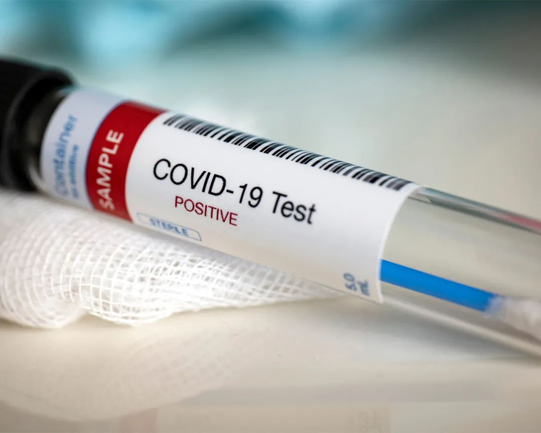 Отдаленные последствия перенесенного COVID-19: в фокусе сахарный диабет
