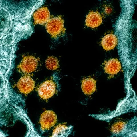 «Eli Lilly» протестирует нейтрализующее антитело из крови выздоровевших от COVID-19