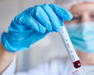 Лабораторні тести показують, що тільки у 60% пацієнтів із COVID-19 виробляються захисні антитіла