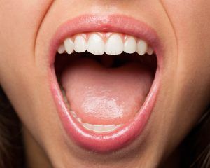 Глоссалгия, глоссодиния или синдром жжения полости рта